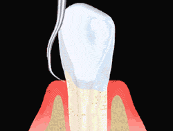 Animated illustration of scaling